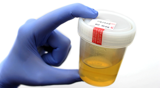 L'analisi delle urine