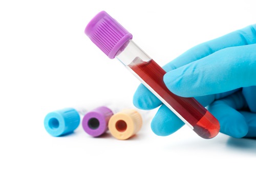 Il check-up: quando serve davvero